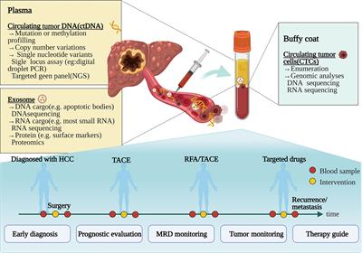 Clinical Applications of Liquid Biopsy in Hepatocellular Carcinoma